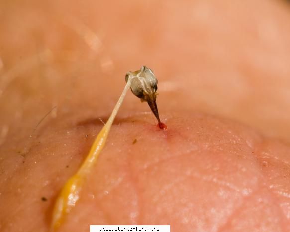 Anatomia albinei - AndreiRN - POZE
